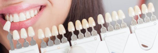 grupollona-blanqueamiento-dental-thumbnail