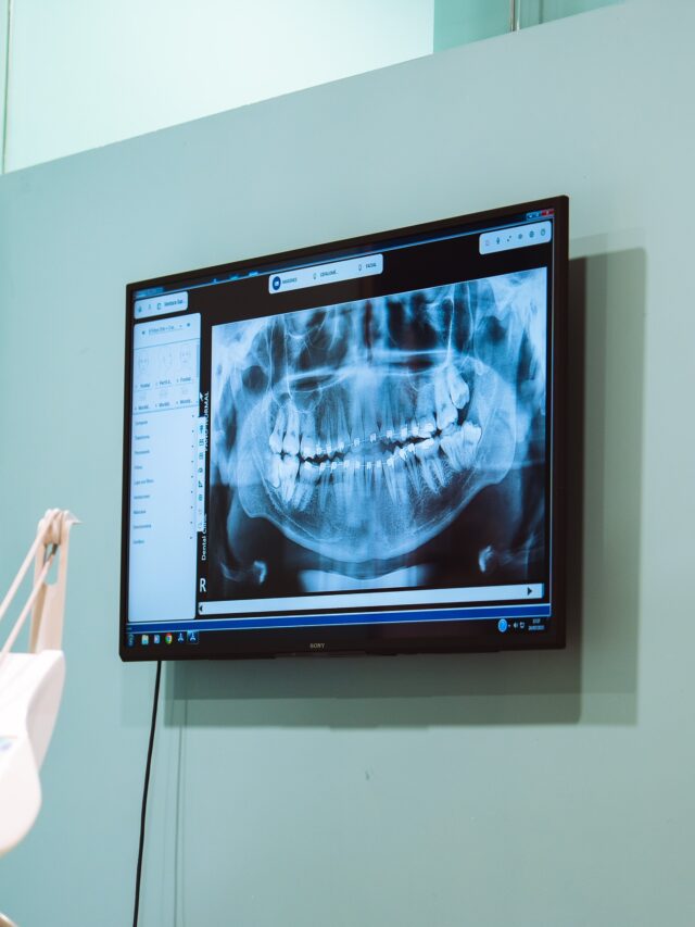 ¡Conoce el poder de la ortopantomografía! 🦷📸 Esta radiografía nos permite ver a fondo la salud de tus dientes y planificar el mejor tratamiento para ti. ¡Cuidar tu sonrisa empieza con un buen diagnóstico!