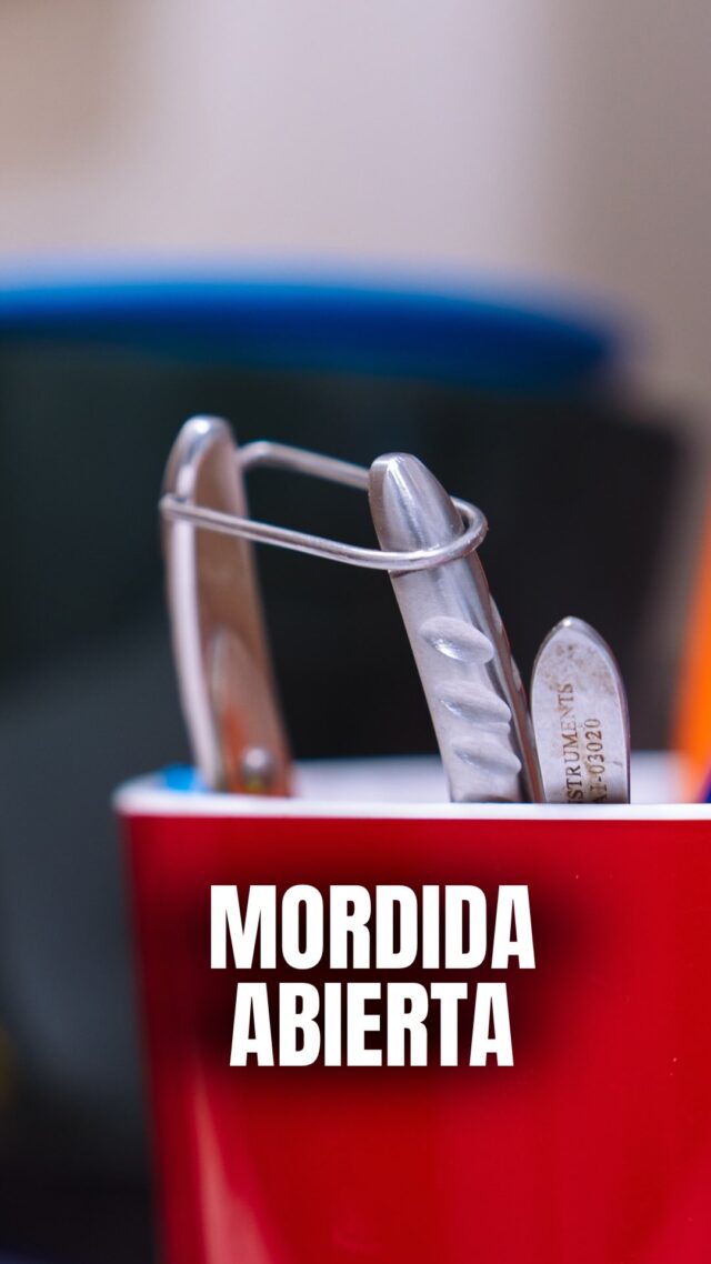 🚨 ¡Atención aitas y amas! El chupete es un gran aliado... pero si se prolonga demasiado, ¡puede abrir la mordida de tu hijo! 😱 

📍C/Colón de Larreategui 17, Bilbao
📍C/Amezti 7 Bajo, Algorta