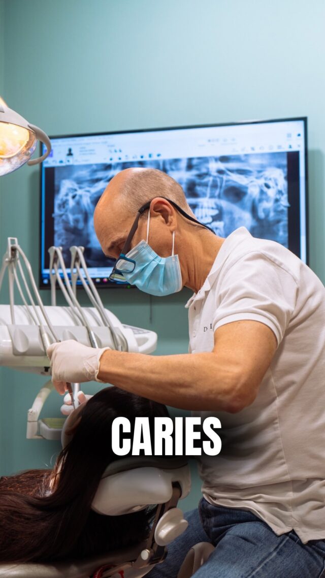 ¿Sabías que NO TODAS las personas tienen el mismo riesgo de caries? 😲 

Factores como la composición de tu saliva o la genética del esmalte pueden hacerte más vulnerable. 

Ven a revisarte en Llona. 🦷✨

📍C/Colón de Larreategui 17, Bilbao
📍C/Amezti 7 Bajo, Algorta