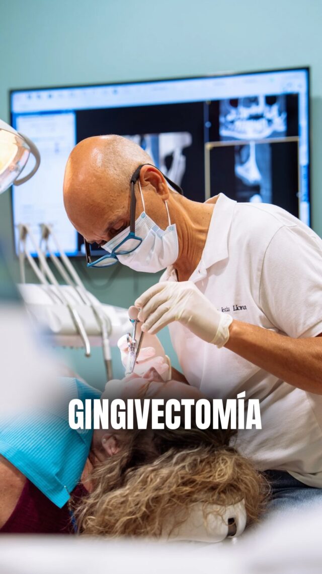 😁 ¿Sabías que tus encías pueden ‘esconder’ tu sonrisa perfecta?

Hoy te explico qué es la gingivectomía.

¡Adiós a las encías que cubren tus dientes y hola a una sonrisa más armónica y confiada! ✨

📍C/Colón de Larreategui 17, Bilbao
📍C/Amezti 7 Bajo, Algorta