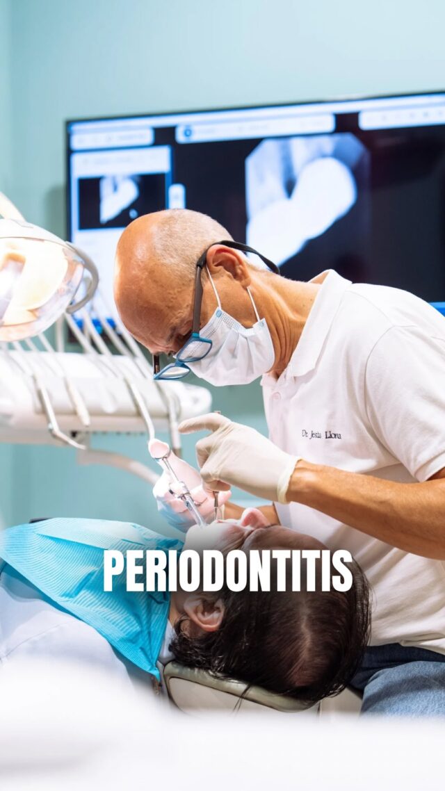 ❌ ¿La periodontitis se puede curar? 
La respuesta clara y sincera: La periodontitis no se cura completamente una vez que ha avanzado y ha destruido hueso, pero SÍ se puede controlar y detener para que no sigas perdiendo dientes ni encías.

📍C/Colón de Larreategui 17, Bilbao
📍C/Amezti 7 Bajo, Algorta