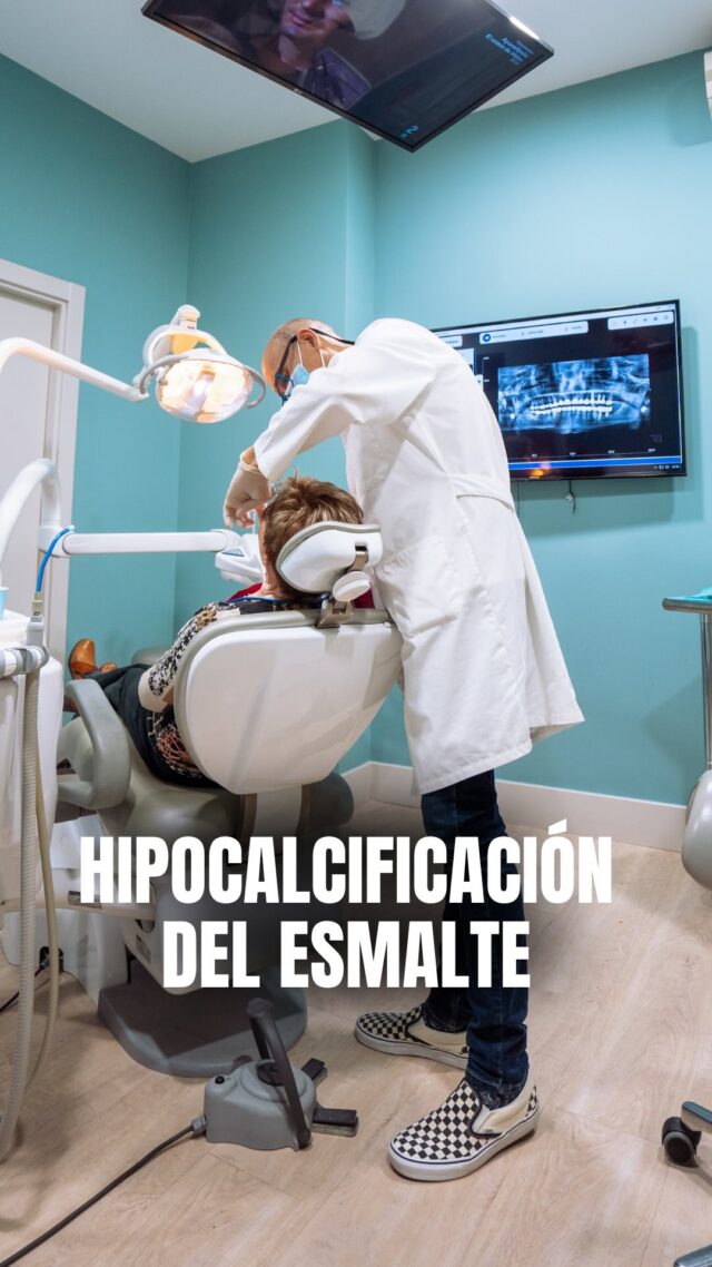 🦷 ¿Por qué aparecen manchas blancas? La hipocalcificación del esmalte

La hipocalcificación es una alteración en la que el esmalte no se mineraliza correctamente. Se ve como manchas blancas opacas, cretáceas o “tiza” en los dientes.

📍C/Colón de Larreategui 17, Bilbao
📍C/Amezti 7 Bajo, Algorta