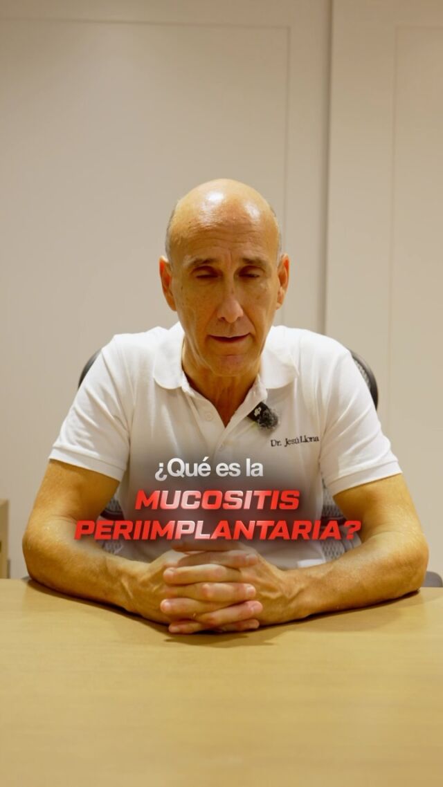 La mucositis periimplantaria es una inflamación de la encía que rodea al implante. Es reversible si se detecta a tiempo. ✅

🚩 Señales de alerta:
🔴 Encía roja o inflamada alrededor del implante
🩸 Sangrado al cepillarte o al usar el hilo
😣 Molestias o sensibilidad en la zona

¿Por qué aparece? Principalmente por la acumulación de placa bacteriana. El tabaco, la diabetes, haber tenido enfermedad periodontal o no acudir a las revisiones aumentan el riesgo.

⚠️ Si no se trata, puede evolucionar a periimplantitis, donde ya se pierde hueso alrededor del implante y el tratamiento es mucho más complejo.

📍C/Colón de Larreategui 17, Bilbao
📍C/Amezti 7 Bajo, Algorta