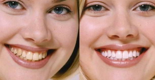 Estética dental Bilbao